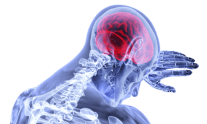 Traumatic Brain Injury Victim in Hollywood Florida