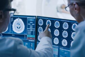 doctors analyzing brain scan